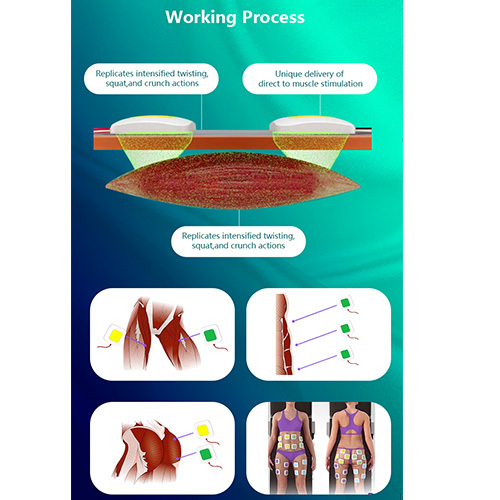 professional Trusculpt ID EMS electrical muscle stimulation body shape Machine
