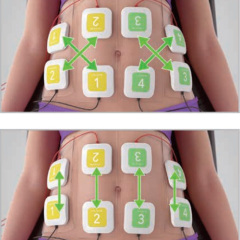 professional Trusculpt ID EMS electrical muscle stimulation body shape Machine