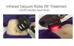 2023 New Arrival Fat Reduction Body Slimming Vacuum Roller Massage Bodyshaper