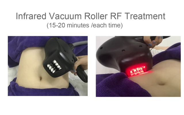 2023 New Arrival Fat Reduction Body Slimming Vacuum Roller Massage Bodyshaper