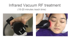 2023 New Arrival Fat Reduction Body Slimming Vacuum Roller Massage Bodyshaper