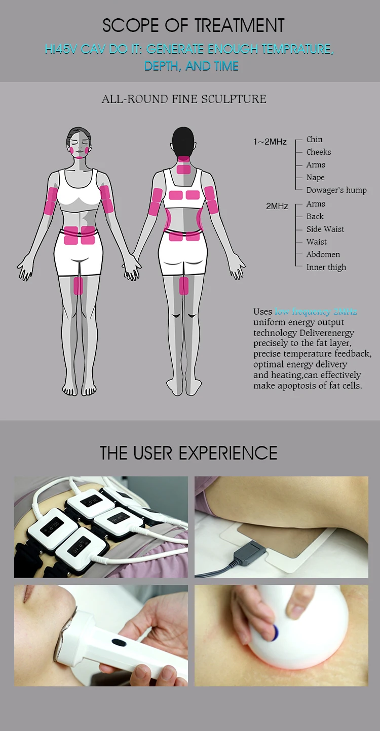 Portable Hands-Free Treatment Trusculpt 3D For Double Chin Removal Trusculpt Id And Flex Ems Muscle Sculpting Machine