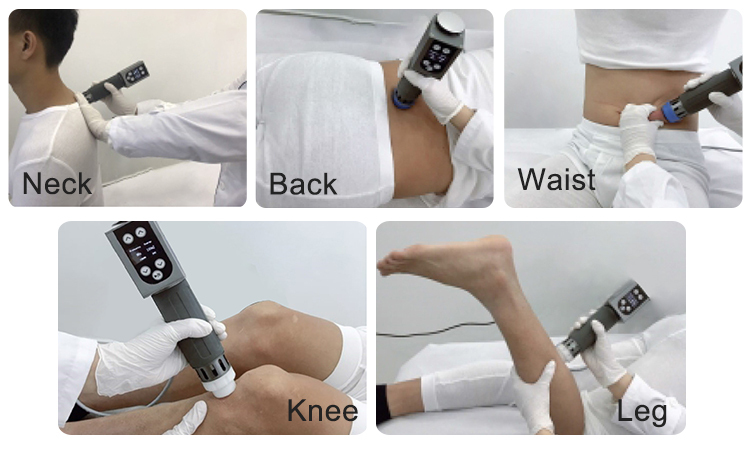 dual Shockwave Therapy Machine for sport injury recovery