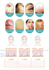 Professional Rf Microneedling Scarring Removal Skin Tightening Micro Needling Machine