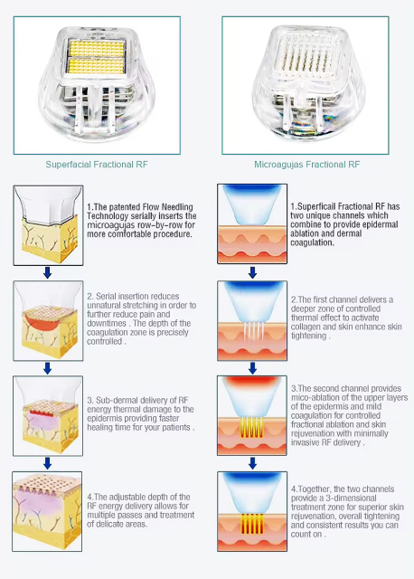 Professional Rf Microneedling Scarring Removal Skin Tightening Micro Needling Machine
