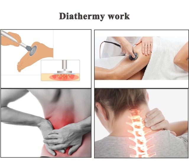 Tecar Therapy Diathermy Machine CET RET For Rehabilitator Sport Tecar Machine