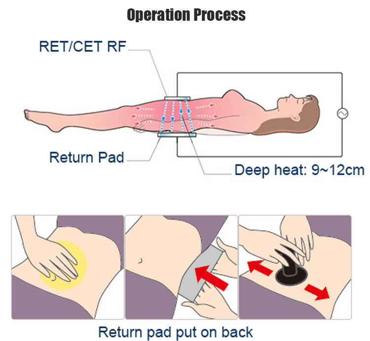 Tecar Therapy Diathermy Machine CET RET For Rehabilitator Sport Tecar Machine