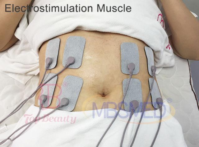 448KHZ Indiba Tecar Therapy Pain Relief Indiba Radiofrecuencia Electro Muscle Stimulator Body Sculpting Physiotherapy Machine