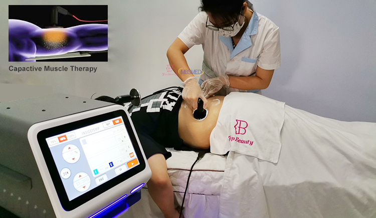448KHZ Indiba Tecar Diatermia Pain Relief Physiotherapy Machine