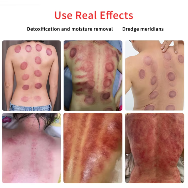 EMS Muscle Stimulator Body Slimming Russian Wave Electrostimulation Fair Cupping Breast Vacuum Therapy Machine