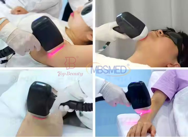 Portable 3 Wavelength Diode Laser Hair Removal Therapy