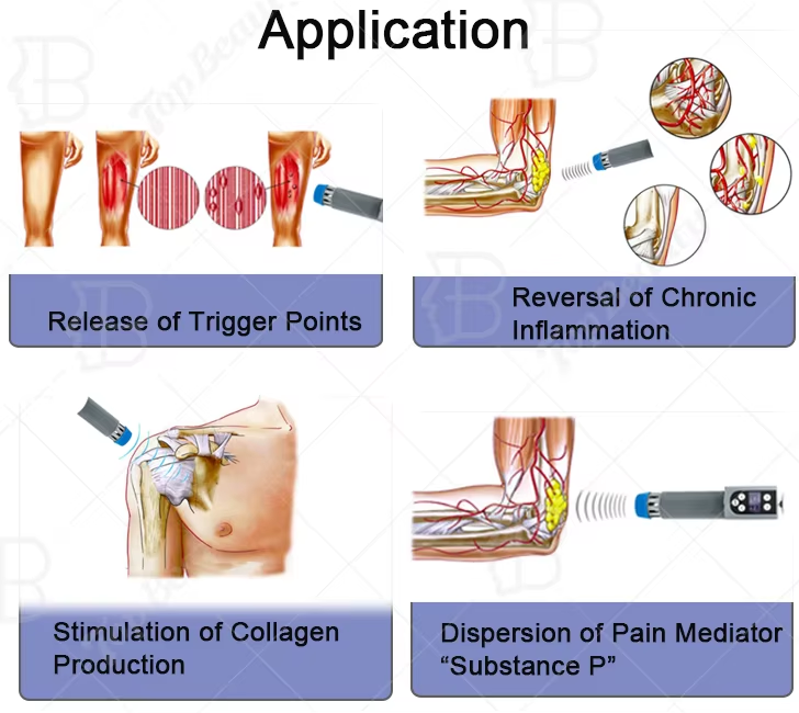Shockwave & EMS & Tecar Therapy Application