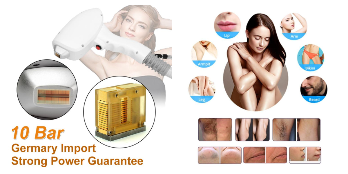 3 Wavelength Diode Laser Handle & Treatment Areas