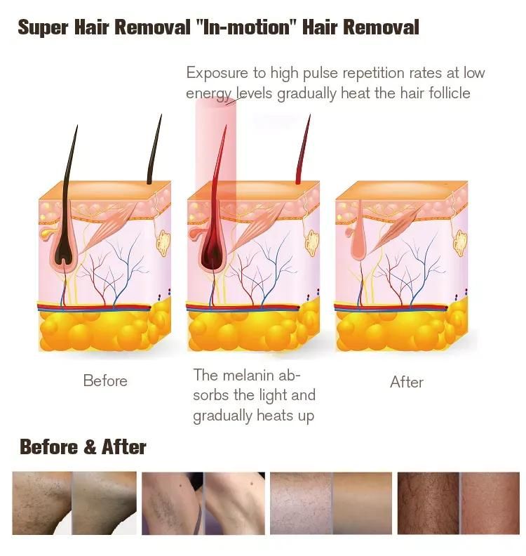 Pneumatic Shockwave & Laser Therapy Machine Details