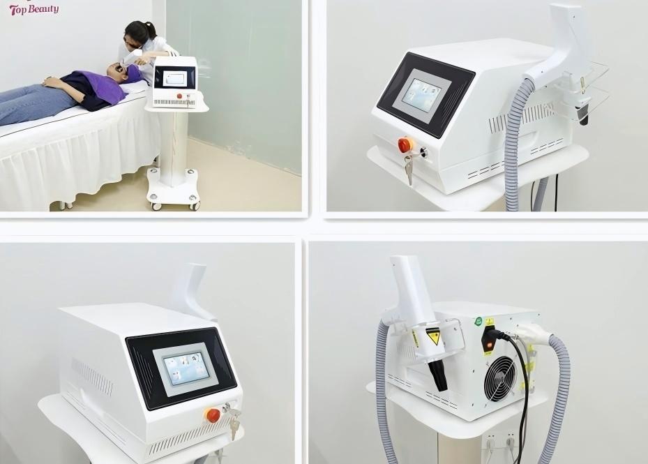 Portable Q Switch Nd Yag Laser Tattoo Removal Machine Details