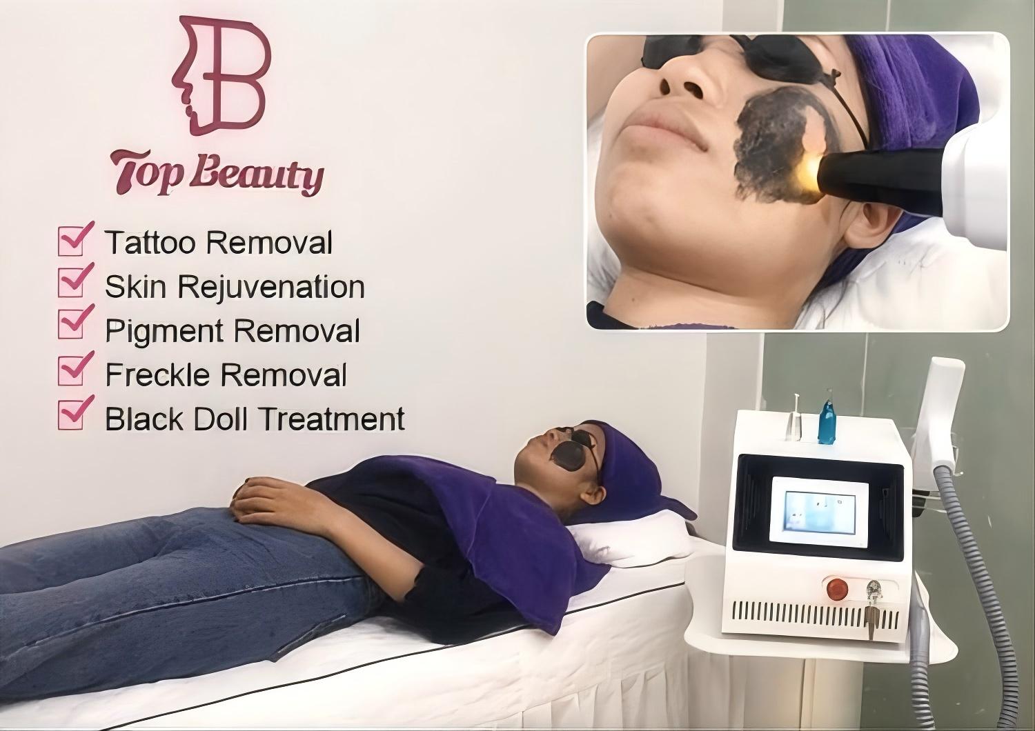 Portable Q Switch Nd Yag Laser Tattoo Removal Machine