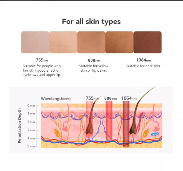 Portable Triple-Wavelength Diode Laser Hair Removal Machine