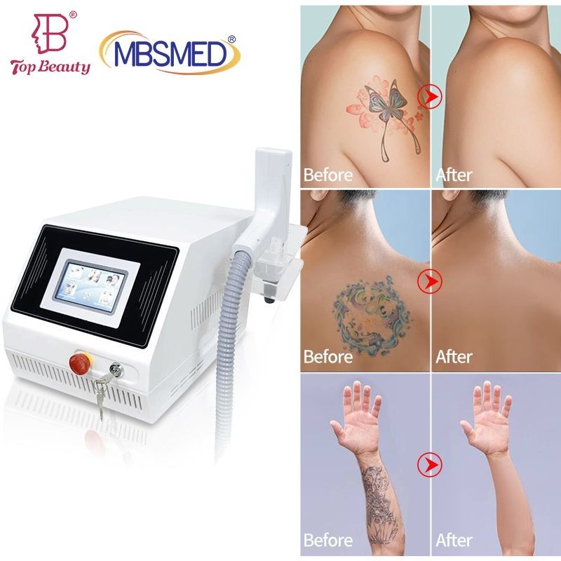 Portable Q Switch Nd Yag Laser Tattoo Removal Machine