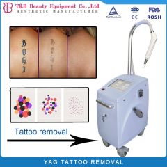 Q Switched Nd Yag Laser Pigment Tattoo Removal Machine