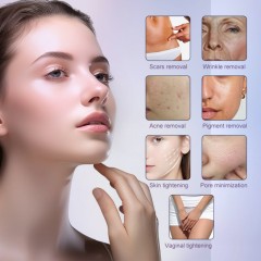 Portable Professional Fractional CO2 Laser Machine for Anti-Aging Vaginal Tightening