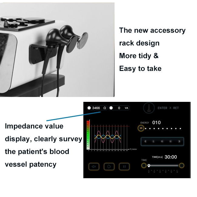 TB-RF05B 448KHz Tecar Therapy Machine Advantages