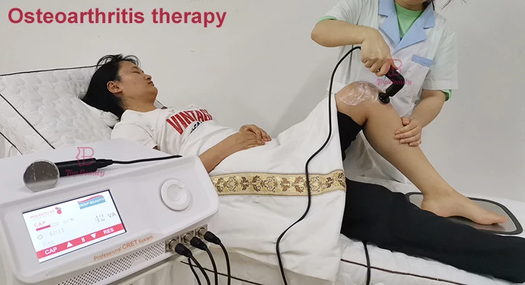 Benefit of 448Khz Tecar Machine