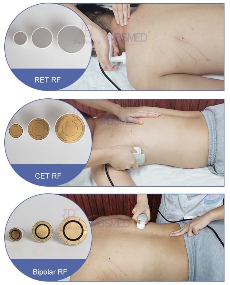 6-IN-1 448KHz Tecar Therapy Machine with CET/RET/Bipolar RF/RET