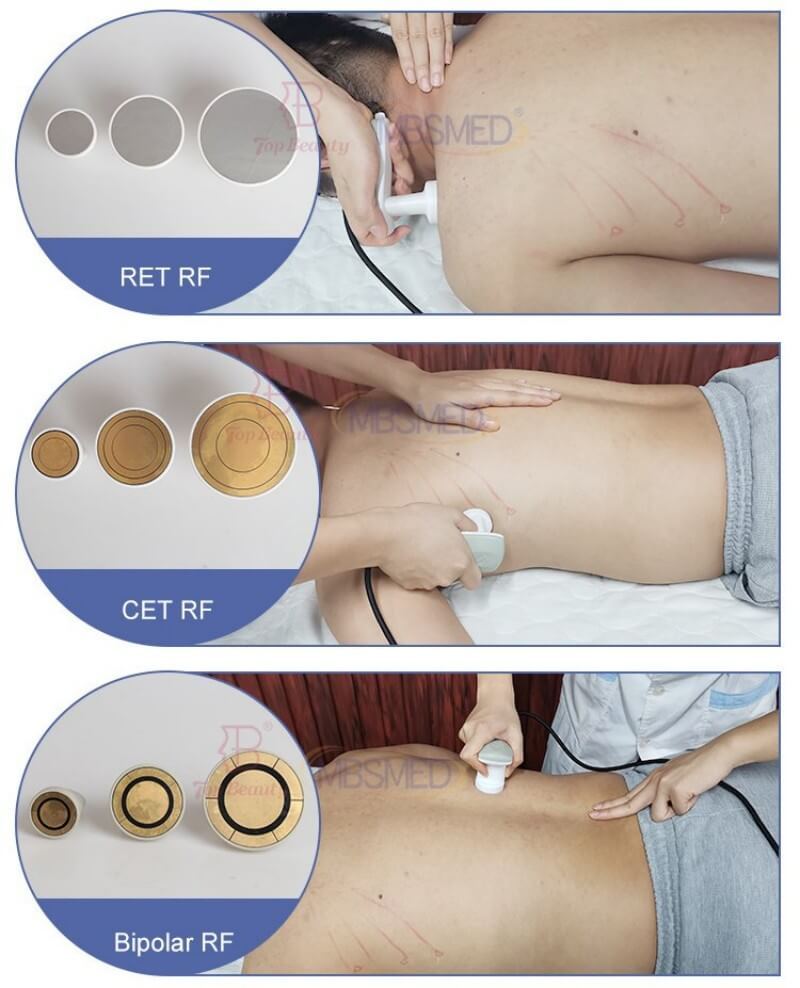 6-IN-1 448KHz Tecar Therapy Machine with CET/RET/Bipolar RF/RET Pad/Fascia Energy Bone
