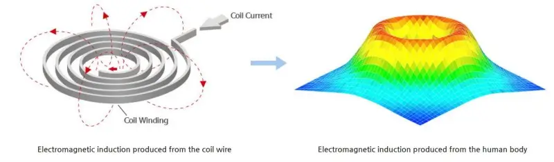How does Magneto Therapy Work?