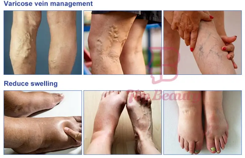 Pressotherapy for Circulatory/Digestive/Lymphatic system