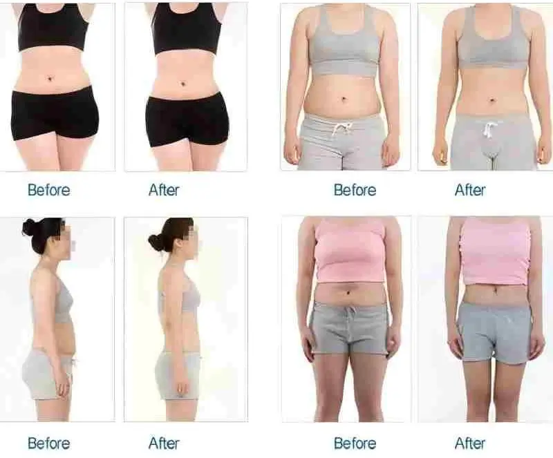 Pressotherapy Lymphatic Drainage Treatment Before and After
