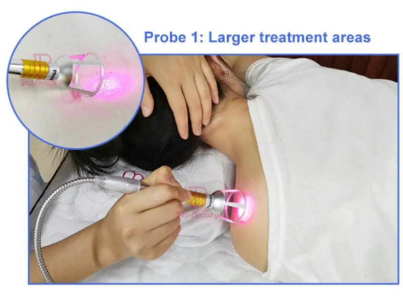 980nm Physical Laser Therapy Machine The hollow probe Handle