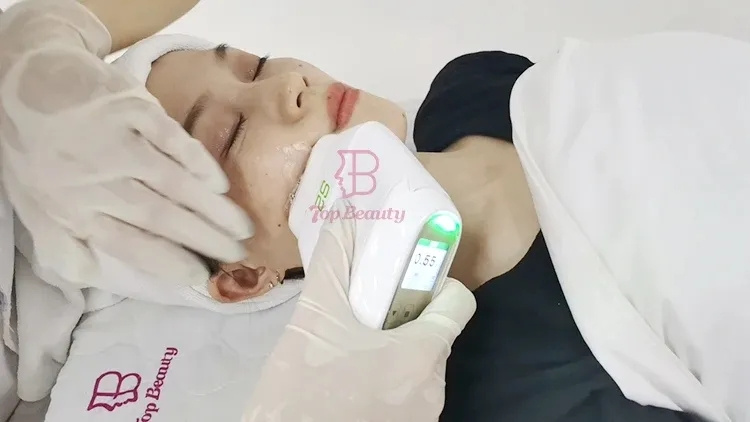 Thermage and HIFU Therapy