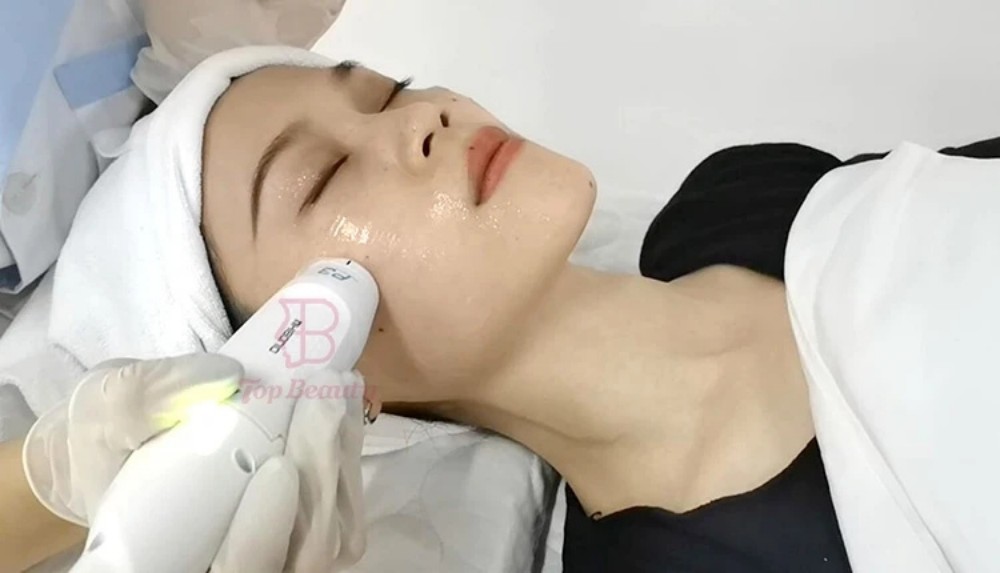 7D HIFU MACHINE TREATMENT