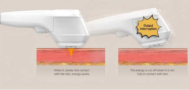 7D HIFU Handle Patented Safety