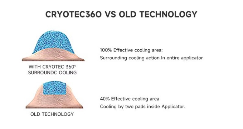 360 Cryolipolysis Machine Technology