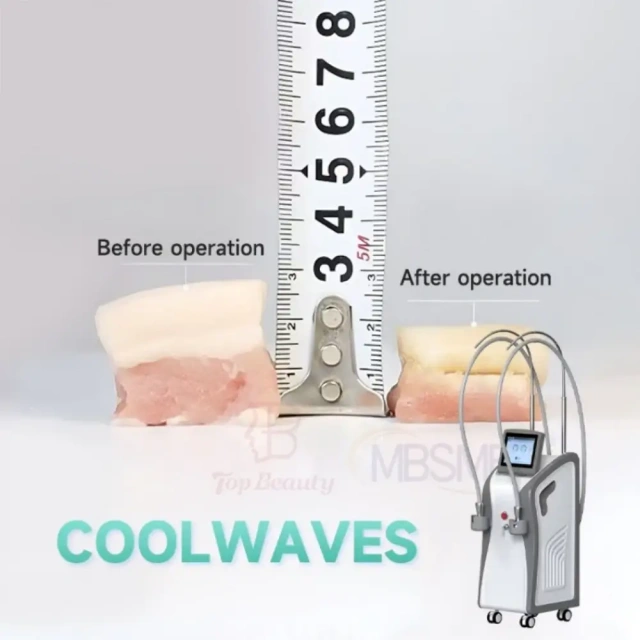 Onda Coolwaves Non-Invasive Body Contouring Machine