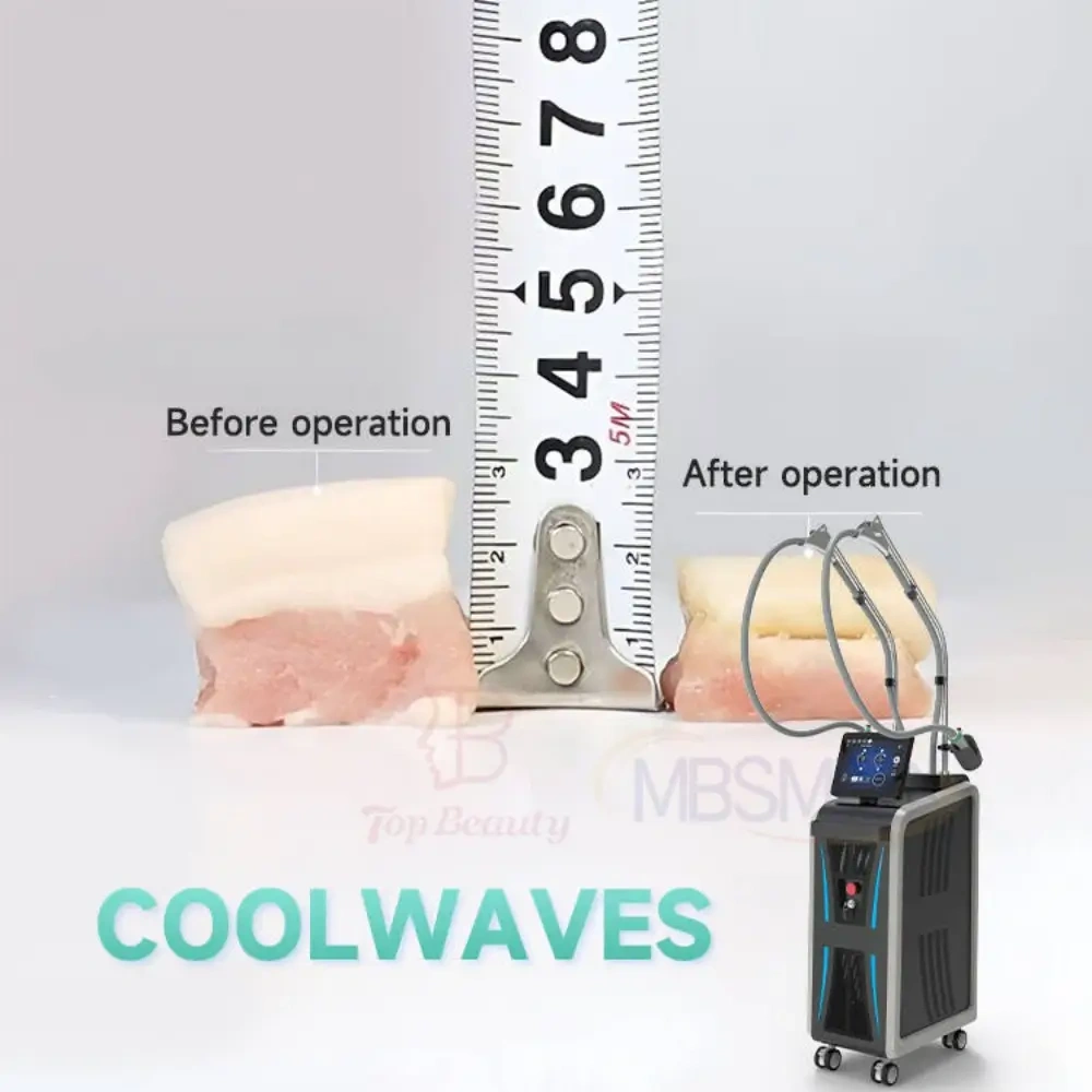 Onda Coolwaves Pro 3 Handpiece Slimming Machine
