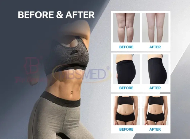 EMS Sculpting Machine for Muscle Building & Fat Reduction