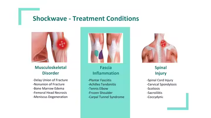 Shockwave Equipment Shockwave Pneumatic Professional Ed Foused Shock Wave Therapy Machine Leg Pain Relief Machine