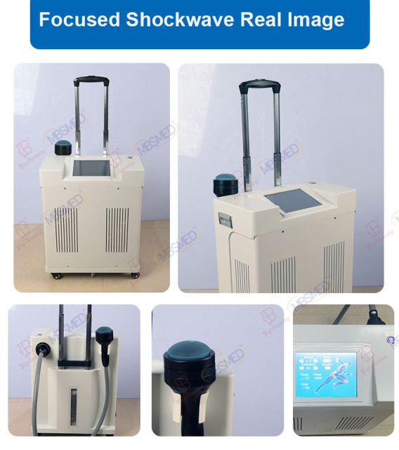 2025 New Softwave Focused Shockwave Therapy Machine Focused Shockwave Therapy For Body Pain Management