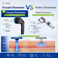 Deepwave Gen 3 Electromagnetic Focused Shockwave Machine for Dissolution of Calcific Fibroblasts
