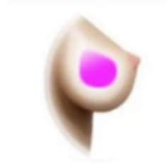Gel breast