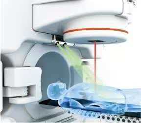 VenusX Medical Linear Accelerator