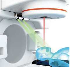 VenusX Medical Linear Accelerator