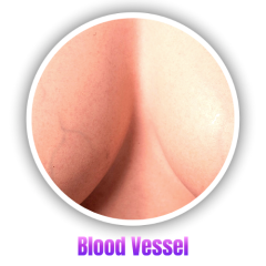 Blood Vessel +Us$60.00