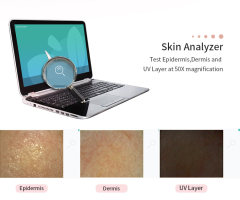 New Model Portable Skin Analyzer