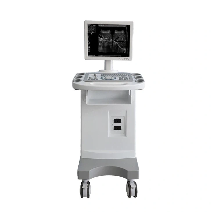 Trolley-Mounted B/W Ultrasound Machine
