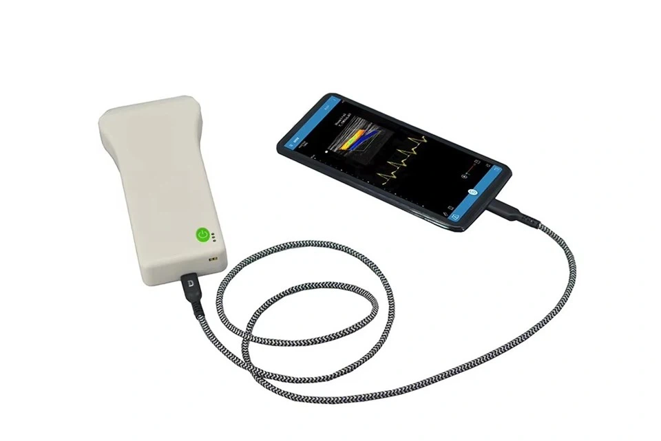 Advanced Handheld Ultrasound Scanner with Color Doppler