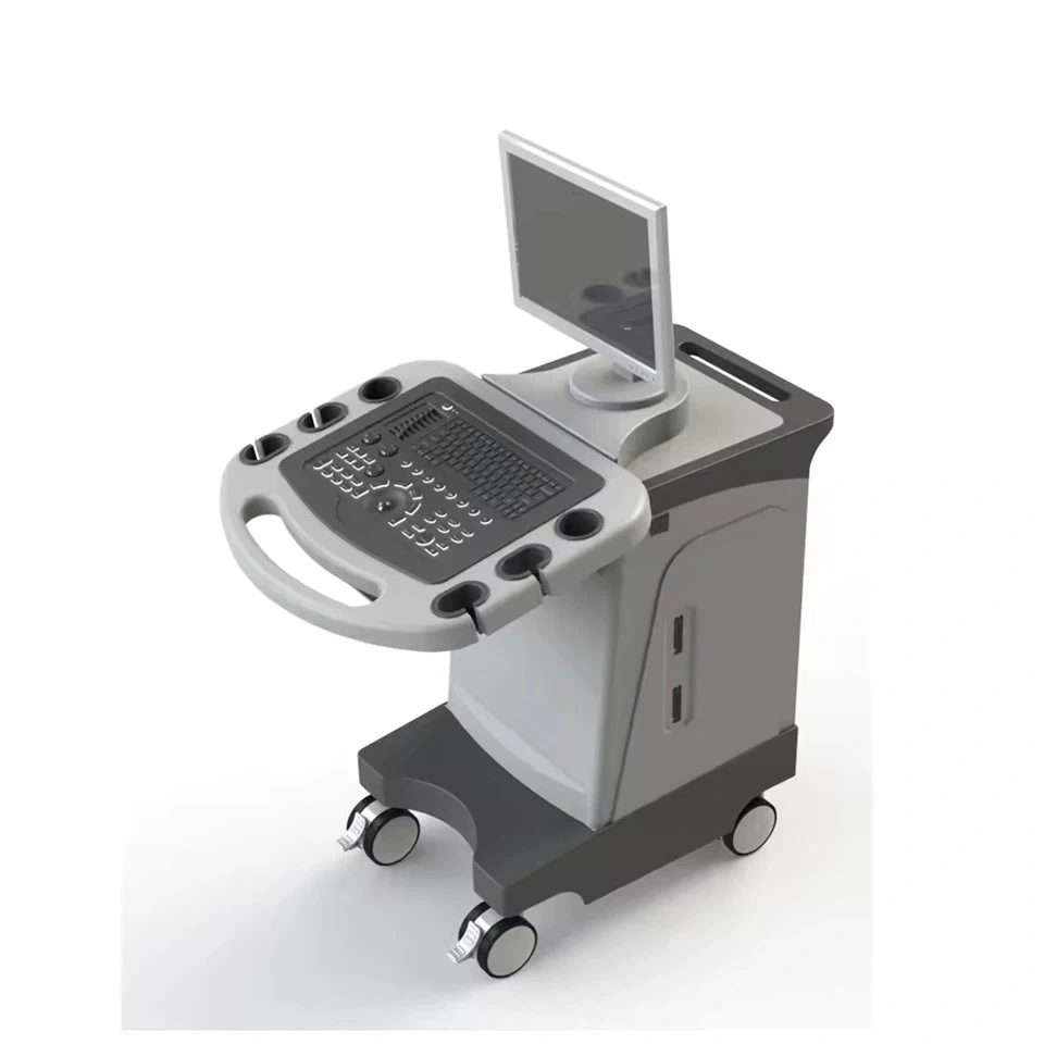 Cart-Mounted Color Doppler Ultrasound System